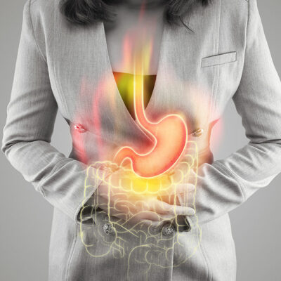 GERD Stages and How to Manage Them