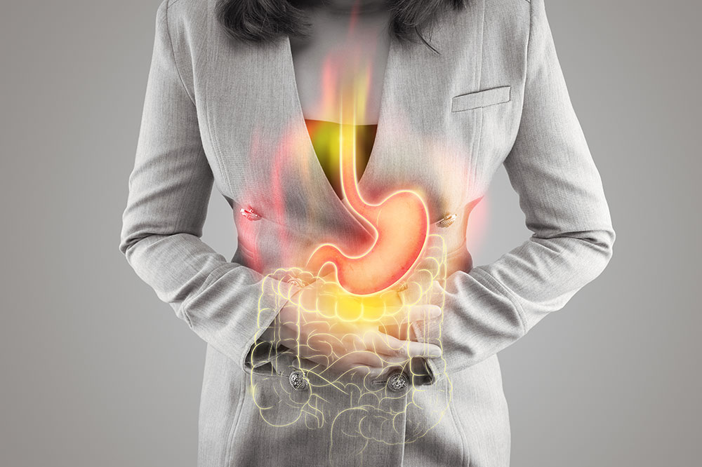GERD Stages and How to Manage Them