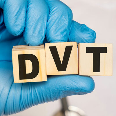 DVT – Complications and Prevention Tips