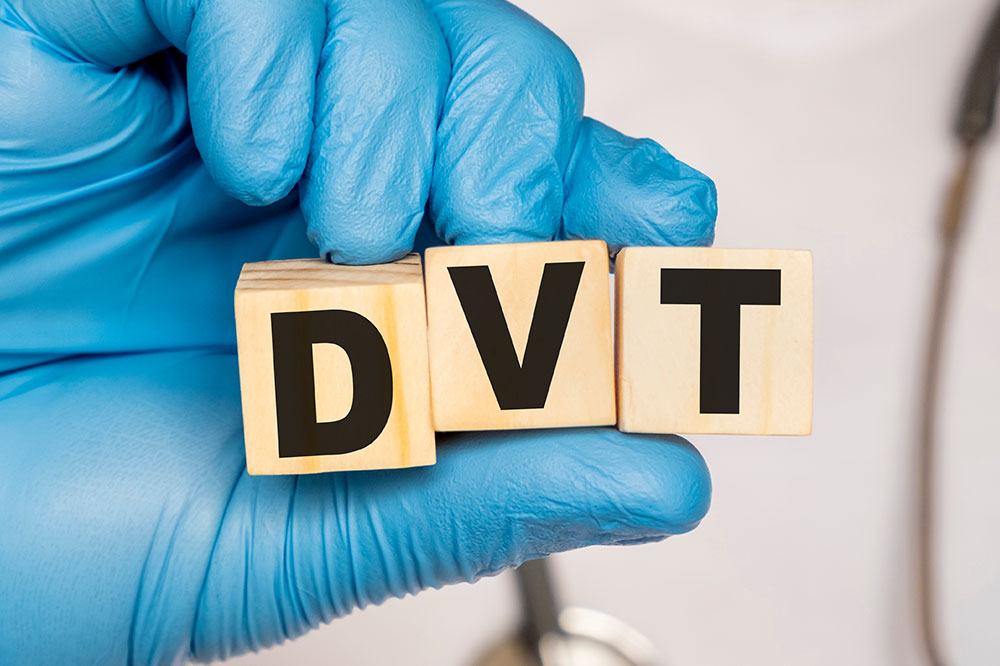 DVT – Complications and Prevention Tips