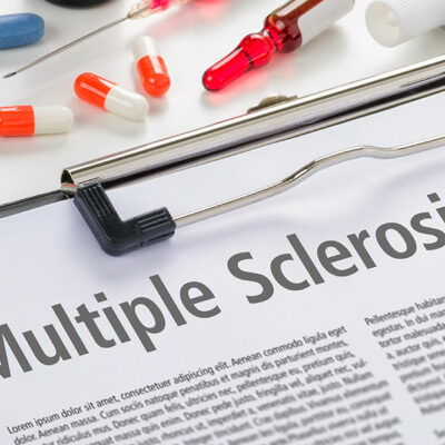 Different Types and Risk Factors for MS