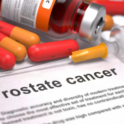 Prostate Cancer Causes and Risk Factors