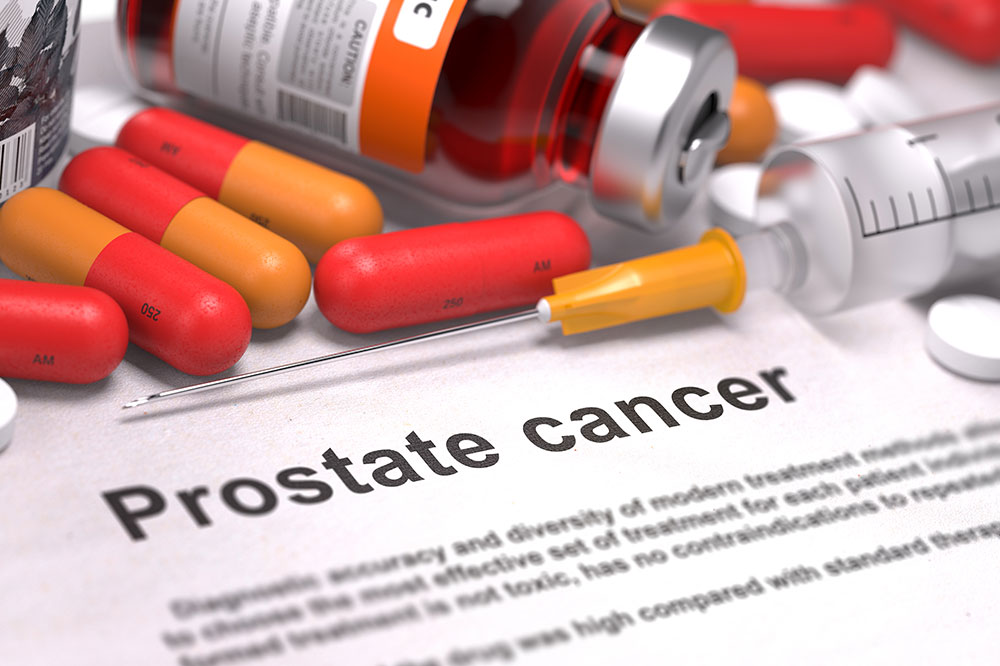 Prostate Cancer Causes and Risk Factors